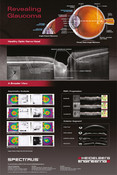 Poster Glaucoma