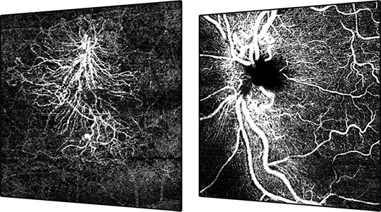 SPECTRALIS OCT - The ophthalmic Imaging Platform | Heidelberg 