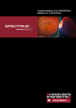 PDF Tutorial SPECTRALIS MultiColor
