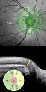 SPECTRALIS GMPE Modalities