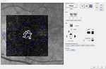 Scan Planning Tool now available for OCTA