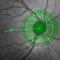 3rd Annual Heidelberg Engineering Academy Glaucoma Masterclass