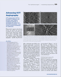 Article in The Ophthalmologist on SPECTRALIS OCT Angiography