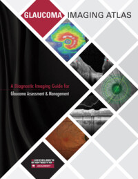 Glaucoma Imaging Atlas Cover