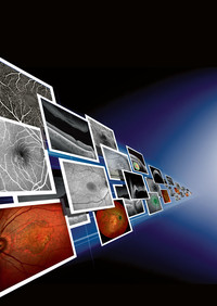 The core DNA of SPECTRALIS