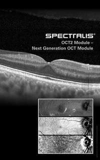 OCT2 Module - Next generation OCT module