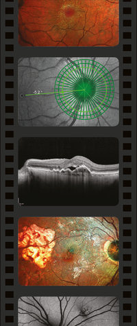 The OCT LIVE format involves imaging patients live at the event.