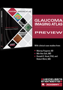 Glaucoma Imaging Atlas Preview Book