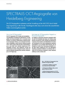 SPECTRALIS OCT Angiografie Heidelberg Engineering