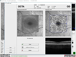 OCTA Quality Check Page
