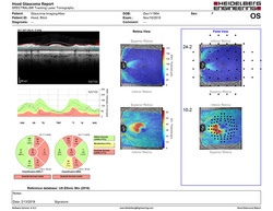 Retina Workflow