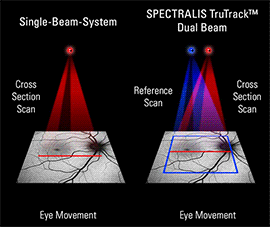 TruTrack Active Eye Tracking