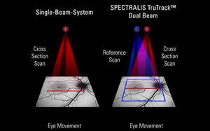 TruTrack Active Eye Tracking