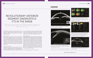  Revolutionary Anterior Segment Diagnostics: It's in the Image 