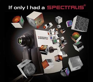 If I only has a SPECTRALIS....