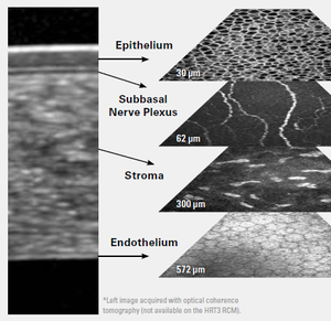 HRT3 RCM Layers