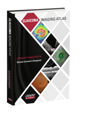 Glaucoma Imaging Atlas