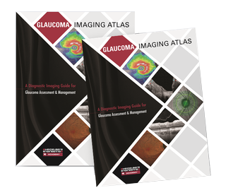 Glaucoma Imaging Atlas