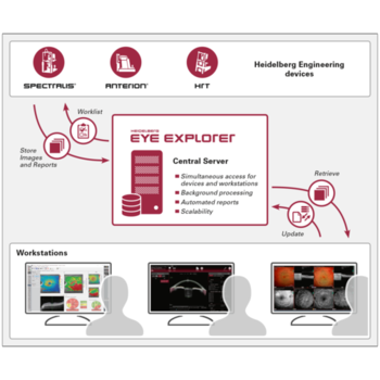 Workflow HEYEX 2