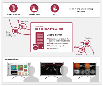 HEYEX 2 Workflow