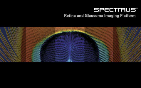 spectralis 7 line raster scan