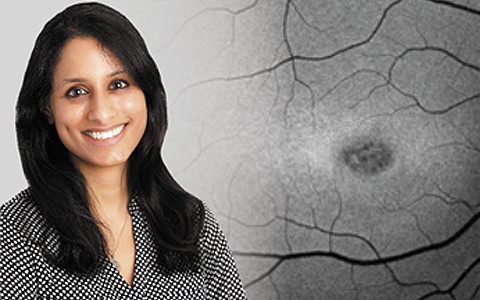Dr. Priya Vakharia (Retina Vitreous Associates of Florida) 