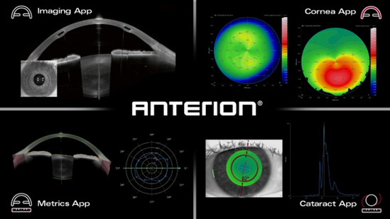 An overview of the 4 apps available for ANTERION.