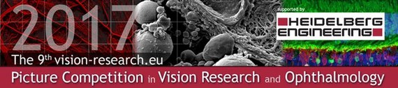 9th Picture Competition in Vision Research and Ophthalmology