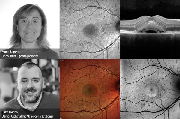 Marta Ugarte, Consultant Ophthalmologist (Medical Retina Specialist) and Luke Carine, Senior Ophthalmic Science Practitioner