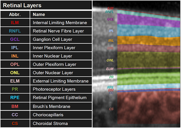 Layers of the Retina - Discovery Eye Foundation