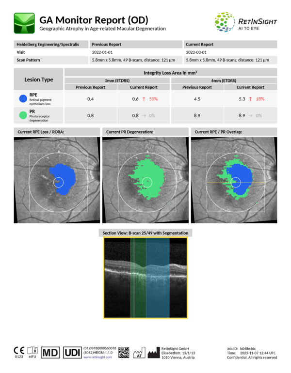 The RetInSight GA Monitor Report