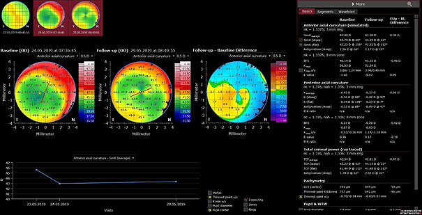 Follow-up view in the ANTERION Cornea App.