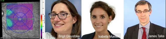 Dr. Brigit Greystoke (Consultant Haematologist), Isabella Mueller (Medical Retina Fellow), James Talks (Consultant Ophthalmologist)