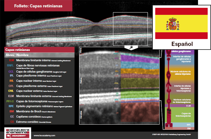 Folleto Capas retinianas ahora disponible en español