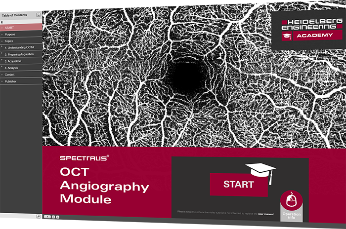 Interactive Video Tutorial for SPECTRALIS OCT Angiography Module